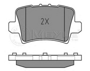 Meyle 0252408615W 